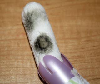 Moldy Tampon Turmoil